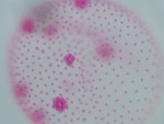 MISSING THUMBNAIL